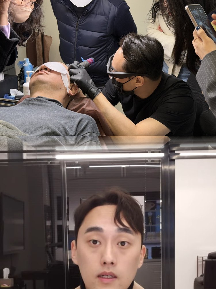 모노피그먼트 두피문신 시술 관련 정보